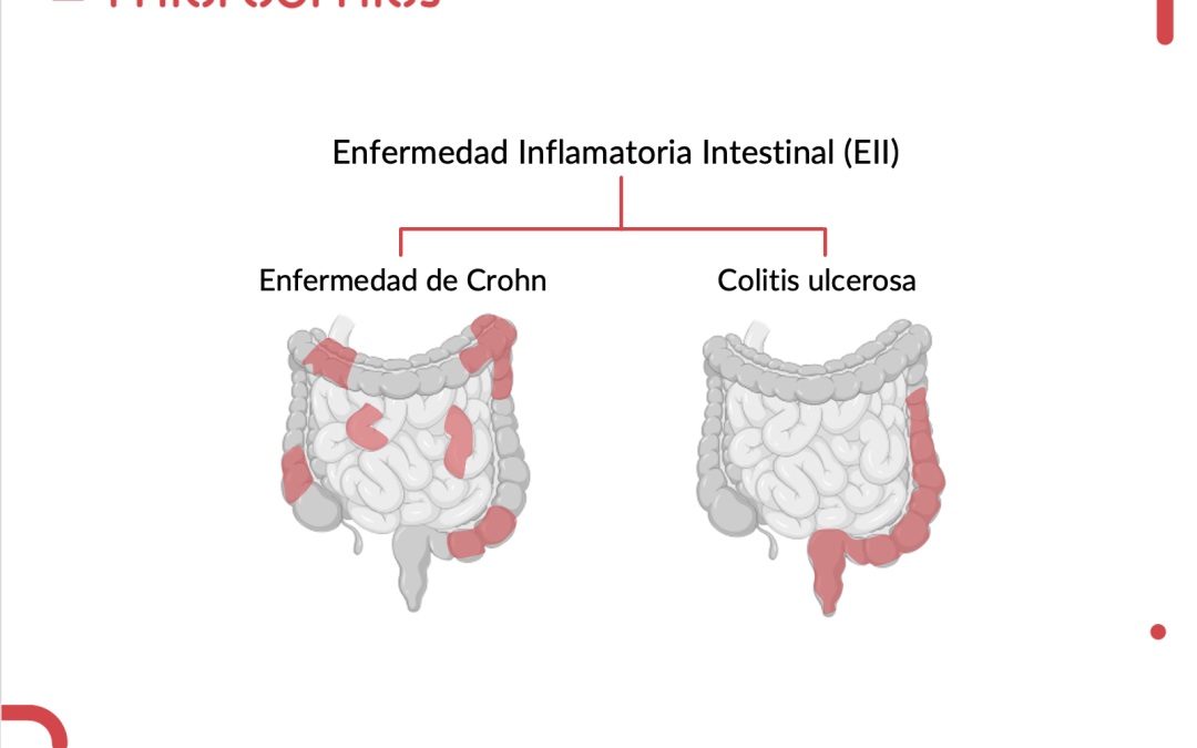May 19: World Inflammatory Bowel Disease Day (IBD)
