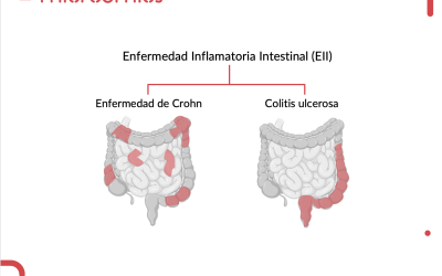 May 19: World Inflammatory Bowel Disease Day (IBD)